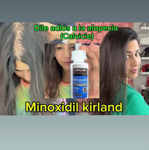 MINOXIDIL KIRLAND